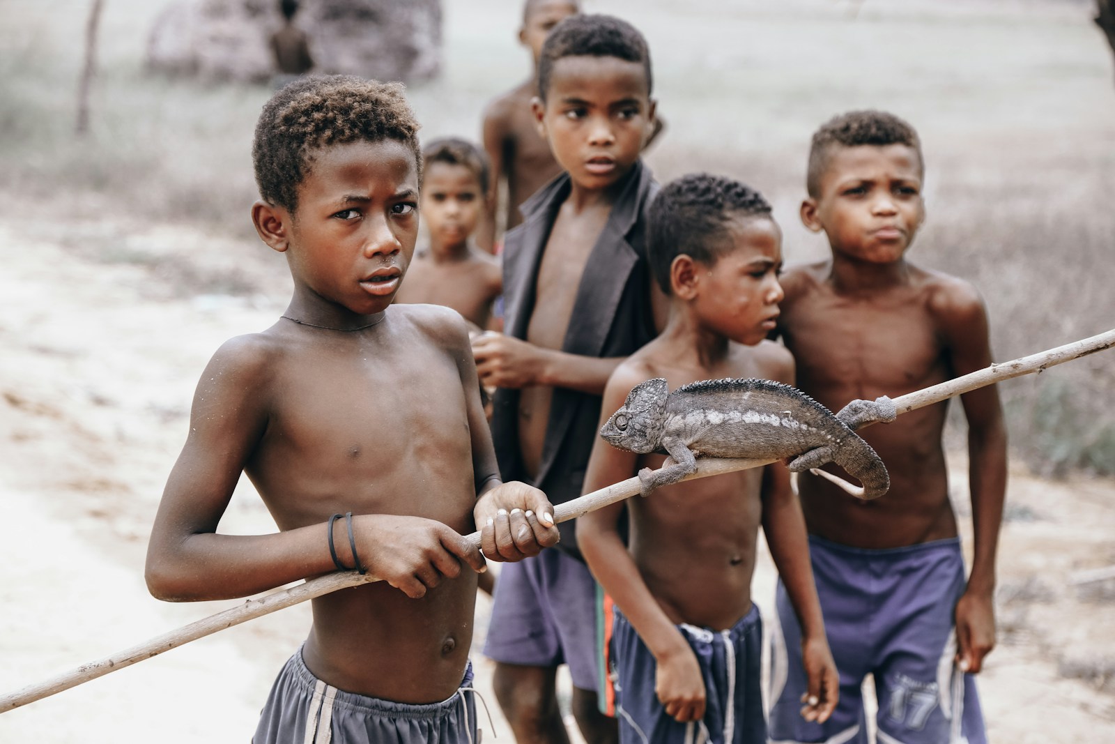 Heartbreaking Child Malnutrition Kano Reality: 5 Urgent Truths Revealed